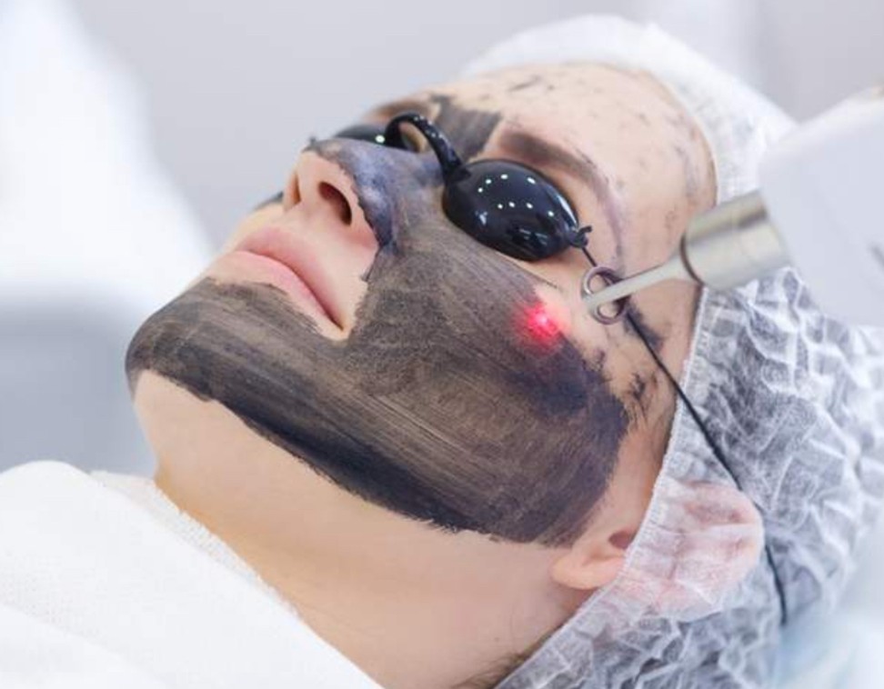 Carbon Facial Treatment Process