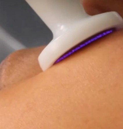 Advanced Plasma Treatment Equipment