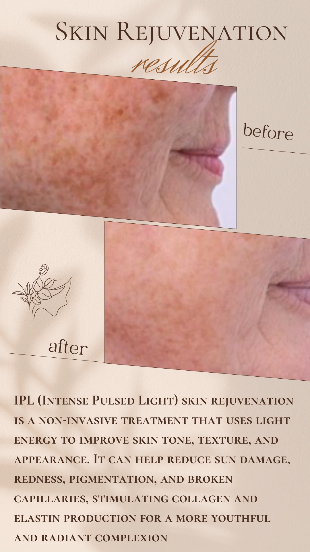 Brows before and after